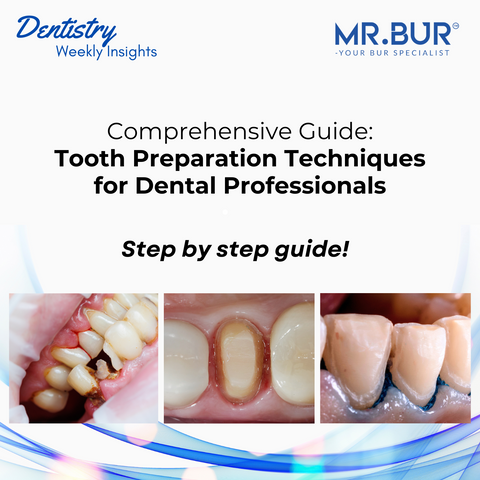 Comprehensive Guide: Tooth Preparation Techniques for Dental Professionals