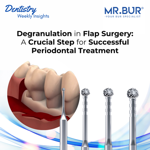  Degranulation in Flap Surgery & Crucial Steps for Successful Periodontal Treatment using Mr. Bur Degranulation Kit