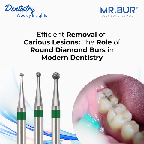 Mr. Bur Round Diamond Burs play a crucial role in the efficient removal of carious lesions, enhancing precision and effectiveness in modern dentistry.