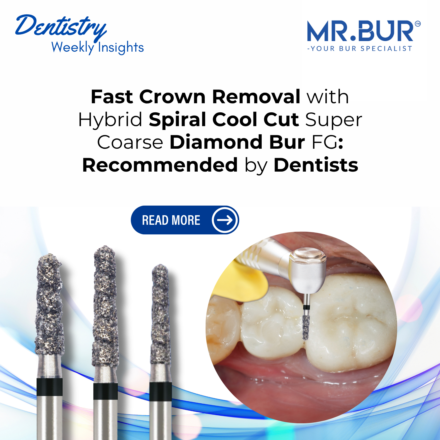 Fast Crown Removal with Hybrid Spiral Cool Cut Super Coarse Diamond Bu ...