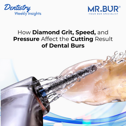 This image shows the method of maximizing dental bur performance: diamond grit, speed, and pressure