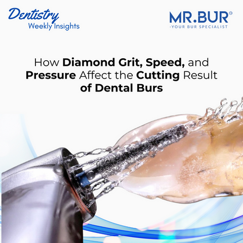 This image shows the method of maximizing dental bur performance: diamond grit, speed, and pressure.