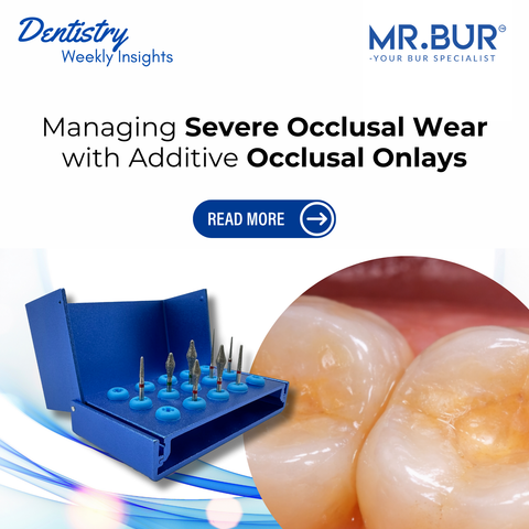 Mr. Bur Occlusal Onlay Kit FG is designed for conservative additive occlusal onlay preparation supporting precise occlusal shaping enamel preservation and anatomy driven restoration in worn dentition cases.