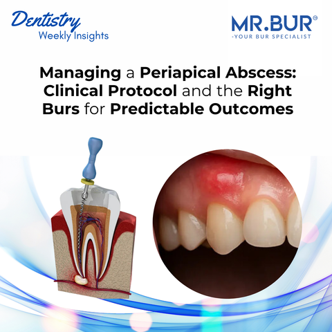Managing a Periapical Abscess: Clinical Protocol and the Right Burs for Predictable Outcomes