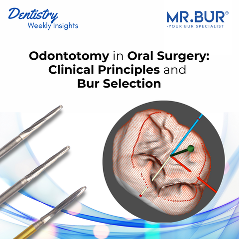 Odontotomy in Oral Surgery: Clinical Principles and Bur Selection