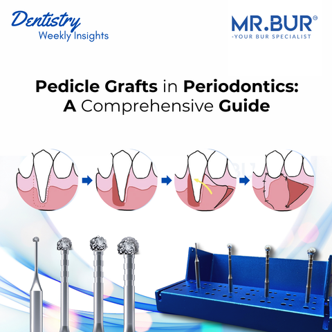 Pedicle grafts in periodontics explained covering techniques benefits and applications for gum recession treatment with precision using Mr Bur Degranulation Kit for optimal tissue management.