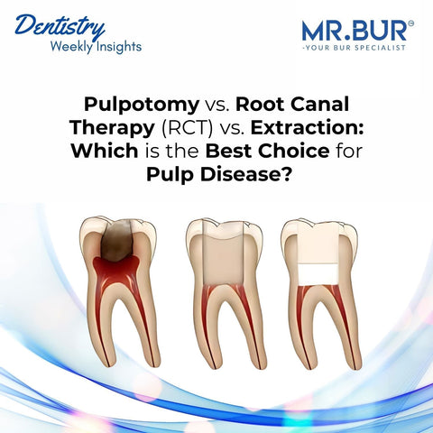 Mr. Bur explores pulpotomy root canal therapy and extraction comparing the best choice for managing pulp disease in different clinical scenarios.