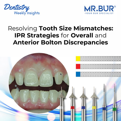Mr. Bur One Slice IPR Kit helps achieve precise interproximal reductions for correcting Overall Bolton Discrepancy with uniform enamel adjustments, ensuring optimal bite and smile alignment.