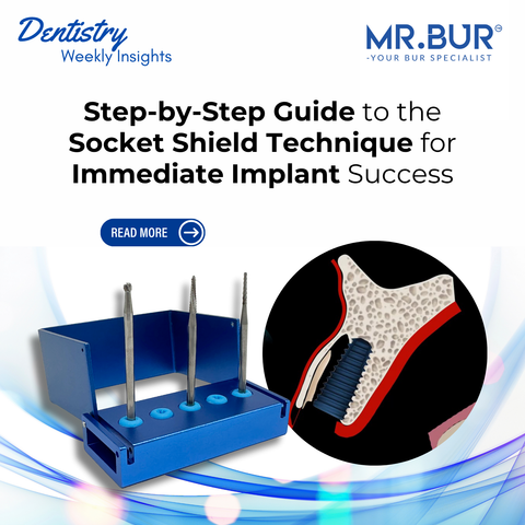 Mr. Bur Lindemann Kit with implant illustration showing socket shield technique for immediate implant placement preserving buccal bone and esthetics.
