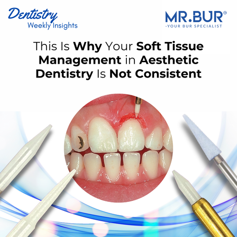 This Is Why Your Soft Tissue Management in Aesthetic Dentistry Is Not Consistent
