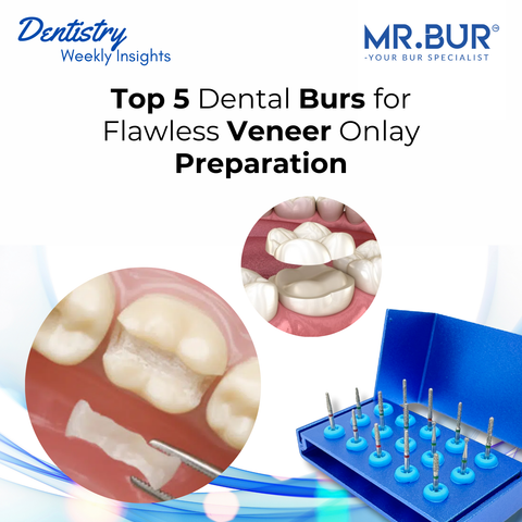 Discover the top 5 Mr. Bur dental burs for flawless veneer onlay preparation, ensuring precise enamel reduction and smooth margin definition.