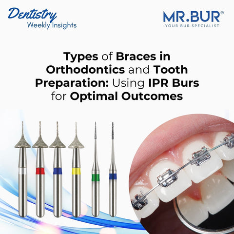 Types of Braces in Orthodontics and Tooth Preparation, Achieving Optimal Outcomes with Mr. Bur IPR Burs.