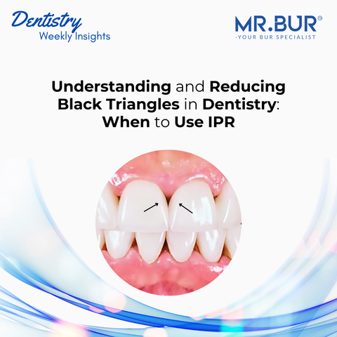 Understanding and Reducing Black Triangles in Dentistry: When to Use IPR, highlighting interproximal reduction (IPR) using Mr. Bur One Slice IPR Kit as a solution for minimizing gaps between teeth.