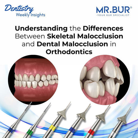 Understanding skeletal malocclusion vs dental malocclusion in orthodontics, Mr. Bur explores causes, diagnosis, and treatment strategies for optimal outcomes such as Mr Bur Interproximal Reduction Bur.