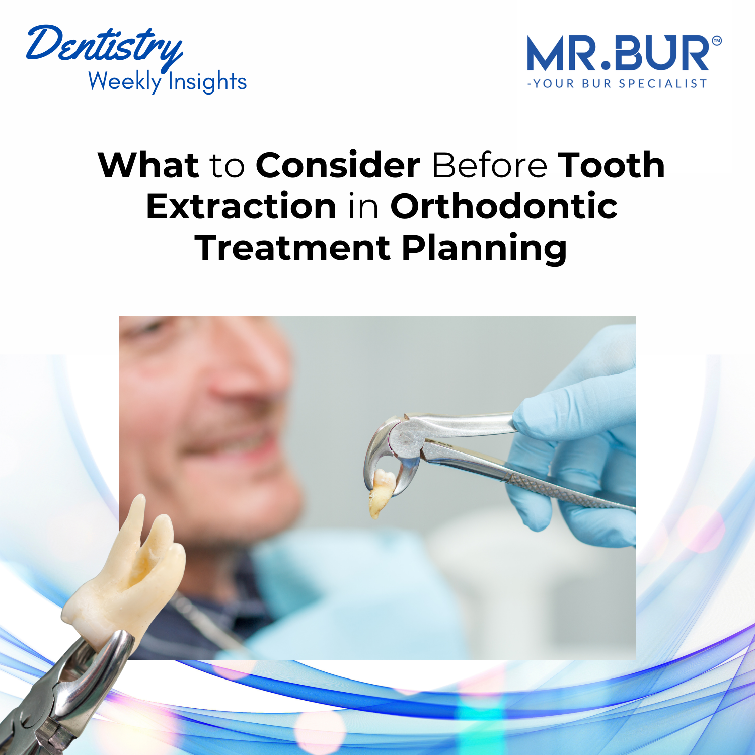 What to Consider Before Tooth Extraction in Orthodontic Treatment Plan ...