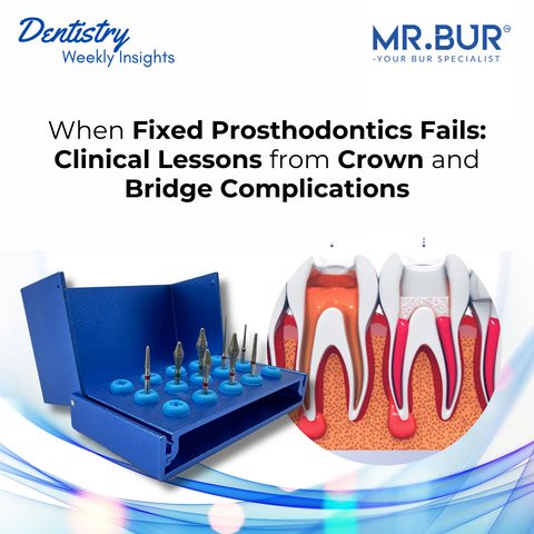 Mr. Bur Occlusal Onlay Kit FG featuring precision occlusal reduction and depth cutting burs designed for controlled crown and onlay preparation.