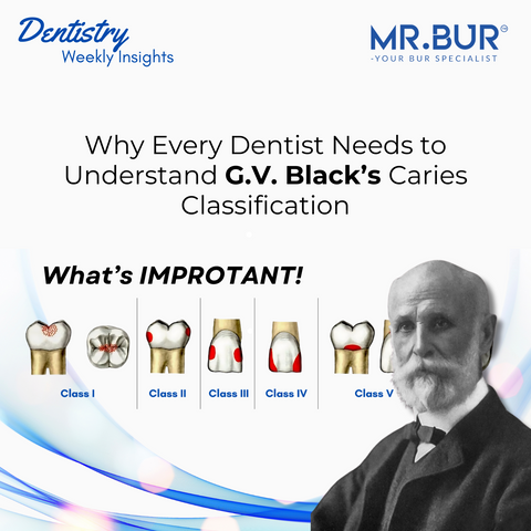 This image explain why every dentist needs to understand G.V. Black’s Caries Classification