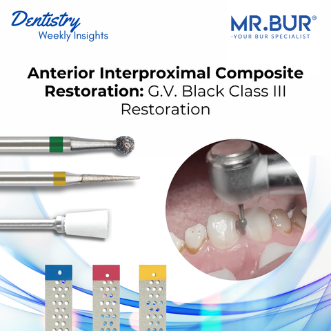 Mr. Bur explains anterior interproximal composite restoration following G.V. Black Class III principles with emphasis on conservative preparation precise finishing and esthetic outcomes.
