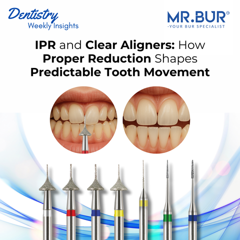 Mr. Bur IPR burs and clear aligner workflow showing how proper interproximal reduction shapes predictable tooth movement.