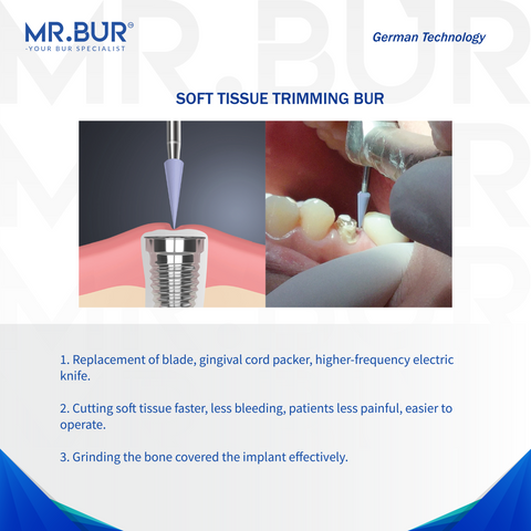 Mr. Bur Soft Tissue Trimmer Ceramic Burs are essential for precise soft tissue contouring and removal in periodontal and surgical procedures, ensuring minimal tissue trauma and faster healing. 