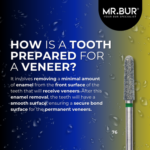 This picture explain how is a tooth prepared for a veneer, It involves removing a minimal amount of enamel from the front surface. 