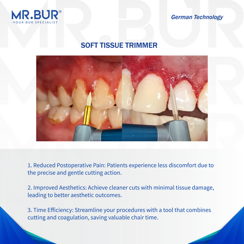 Best MR.BUR ceramic bur for soft tissue trimming delivers precision, durability, and efficient soft tissue management for dental professionals.