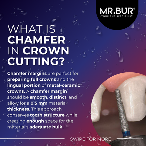 This picture explain what is chamfer in crown cutting, chamfer is margin perfect for preparing full crown and the lingual portion of metal-ceramic crown. Mr Bur taper round end bur is the best choices for creating chamfer margin.