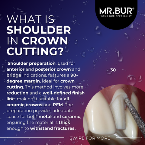 This picture explain what is shoulder in crown cutting, the shoulder preparation can be used for anterior and posterior crown and bridge, ideal for crown cutting. 