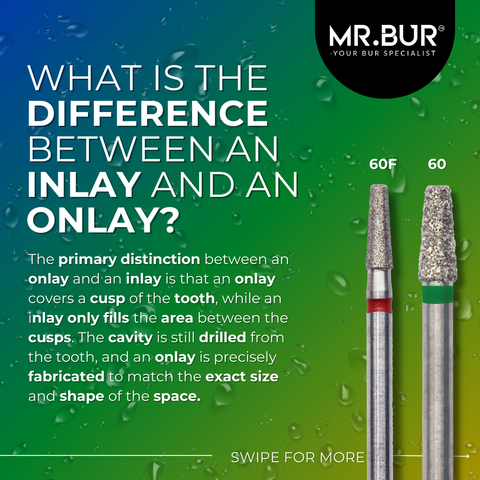 What is the difference between an Inlay and an Onlay?